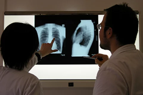 Medical Licensure for Residency Two Doctors Reviewing a Chest X Ray