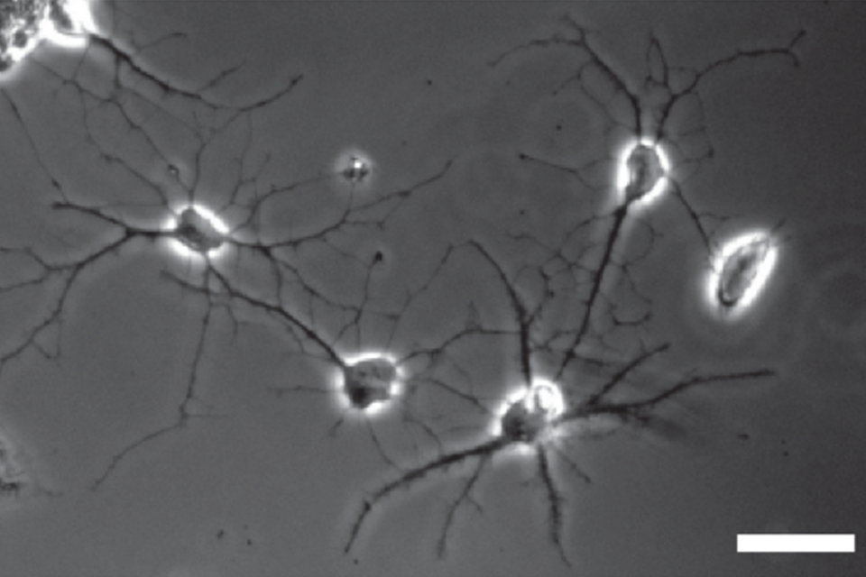 Human Astrocyte - astrocytes and brain disorders