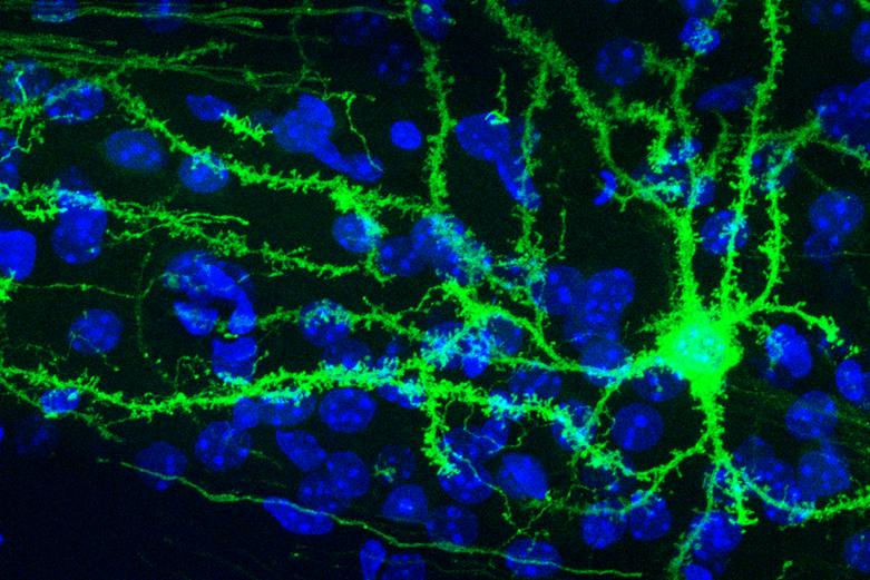 Spiny neuron in the mouse striatum