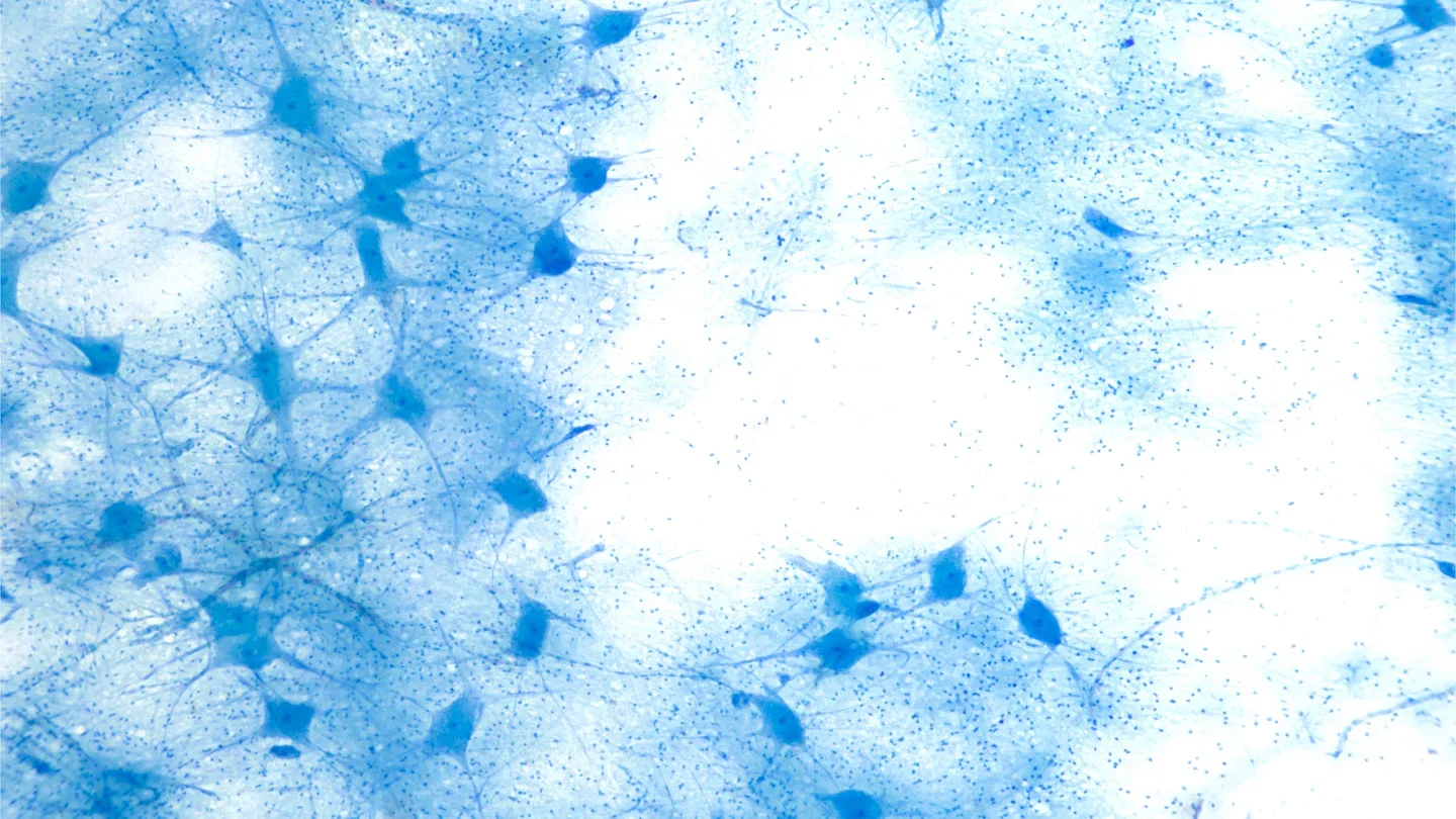 Histology scan of neurons