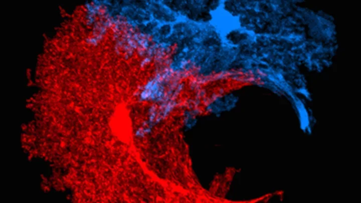 Carmichael-Cortical, Medical School photo