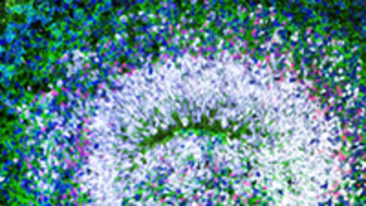 Cross section of organoid 2 - stem cells