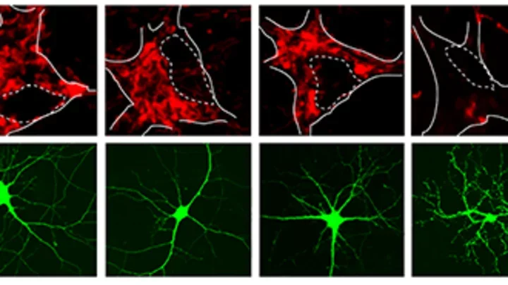 Guo Lab - Genes responsible for familial forms of Parkinson’s disease