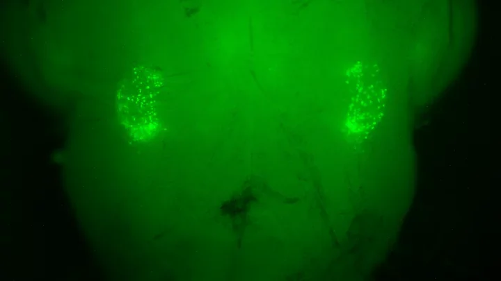 preBötzinger-Complex - The part of brain that controls breathing