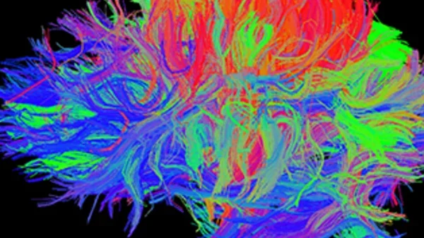Fiber-Track - Medical School photo