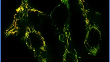Mitochondria Function, Form and Food: A mitochondria fragments itself 