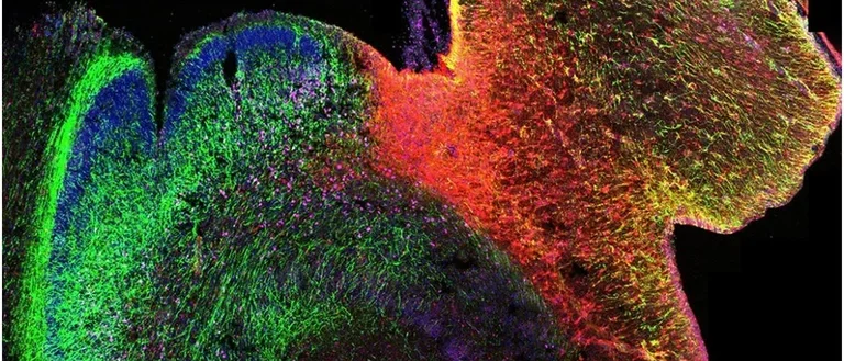 Human Genetics - Highlight - Fluorescent Hippocampus