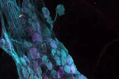 Cardiovascular Seminar Event Image
