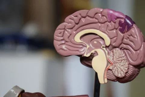 Neurologist vs. neurosurgeon - A brain surgeon's perspective and 3D model of a brain