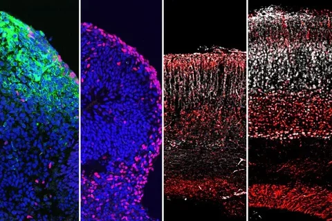 Cell With Zika Virus