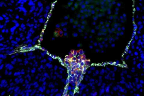 Emerging blood stem cells in aorta