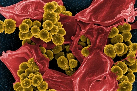 MRSA