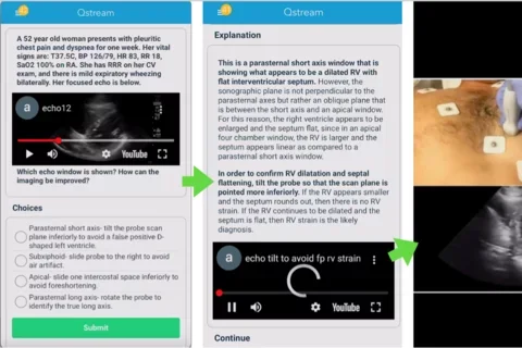 POCUS Q stream screenshot