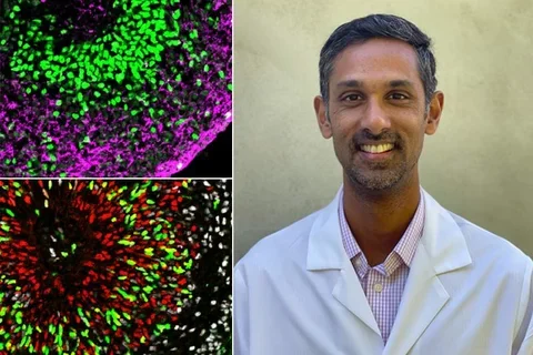 Ranmal and organoids
