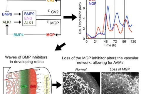 Cardiovascular calcification
