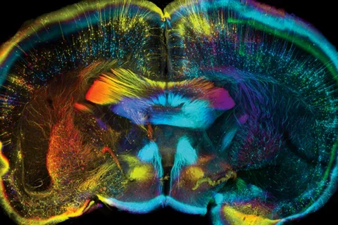 What Is a Psychiatrist? Composite of grey matter in the brain 