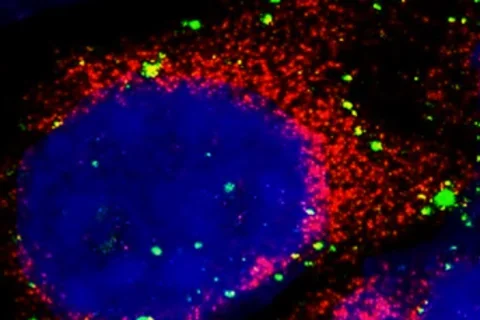 Microscopy image of atherosclerosis