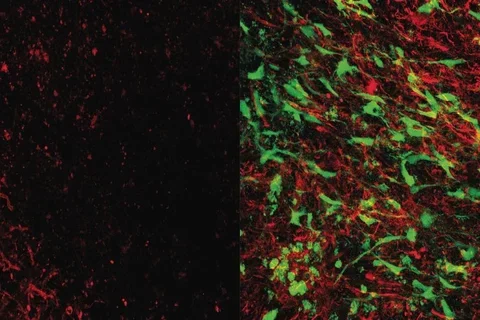 brain tissue