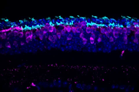 Cone photoreceptors in the degenerating retina