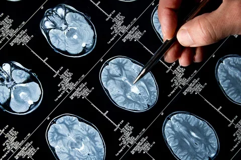 brain scan images