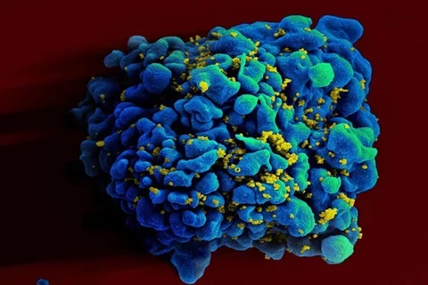 HIV infected H9 T-Cell NIAID