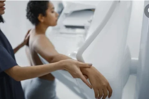Mammography