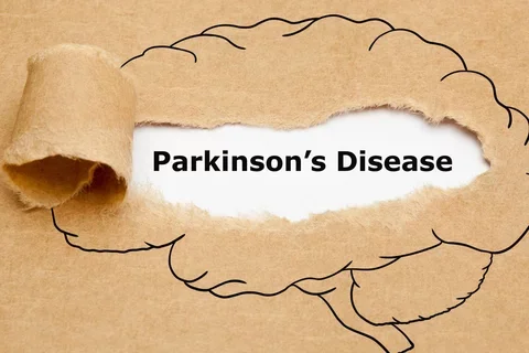 parkinson disease