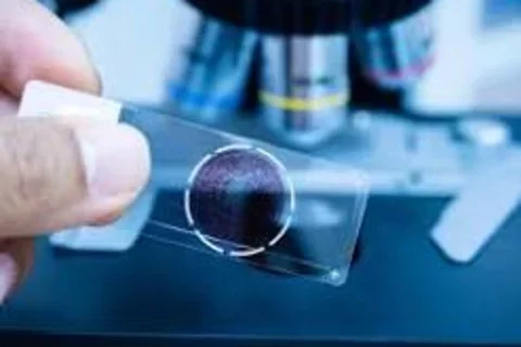 Pathology Slide Image