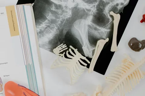 image of skull x-ray on a table with an open book in the corner and small plastic skeleton/body part recreations