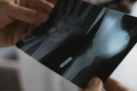 Close-up Photo of an X-ray held by a Doctor