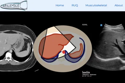 Screenshot of Pocus in Focus website