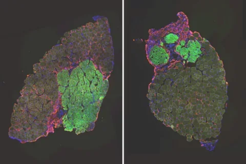Regenerated mouse muscles transplanted with muscle stem cells