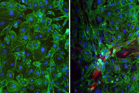 A microscopy still of human stem cell-derived mini heart organoids