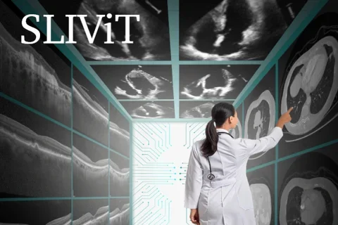 Photographic depiction of UCLA’s computer model SLIViT (SLice Integration by Vision Transformer) 