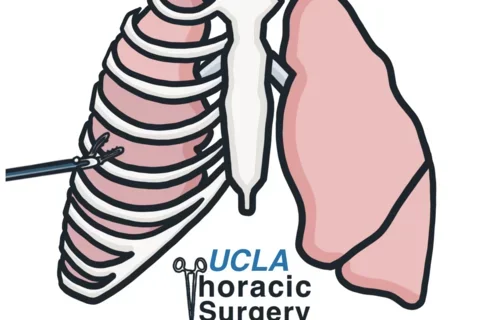 UCLA Thoracic Surgery Interest Group Logo