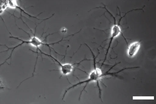 Human Astrocyte - astrocytes and brain disorders