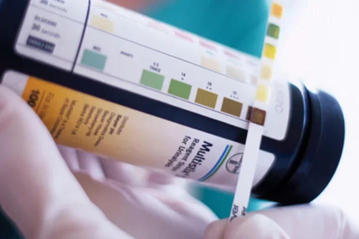 Cancer-Metabolism-Glucose