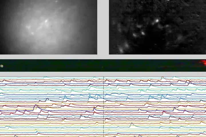 Watching Brain Function