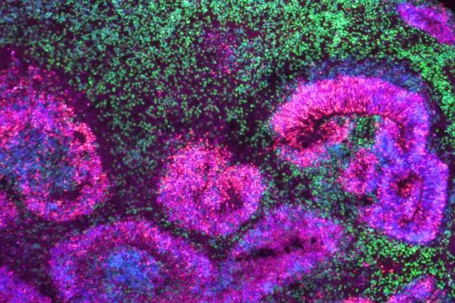 Microscopy image of a cortical organoid, a stem cell-derived model that mimics the developing human brain. 