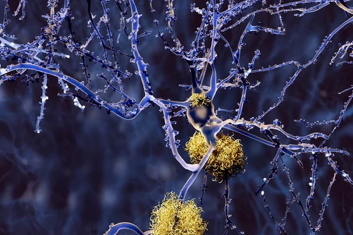 Neurons