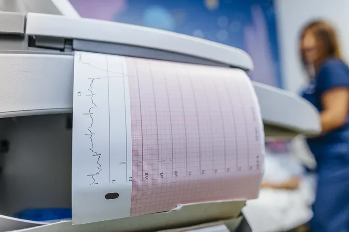 What Is a Cardiologist? Heart rhythm chart 