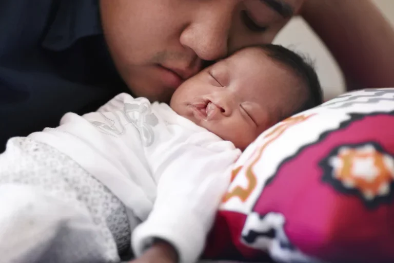 Baby with cleft lip