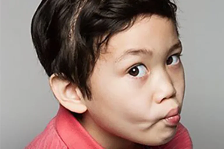 A young boy named Gio with epilepsy