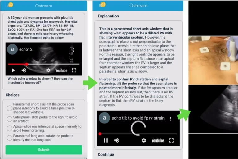 POCUS Q stream screenshot