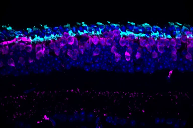 Cone photoreceptors in the degenerating retina