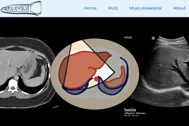 Screenshot of Pocus in Focus website