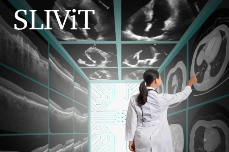 Photographic depiction of UCLA’s computer model SLIViT (SLice Integration by Vision Transformer) 