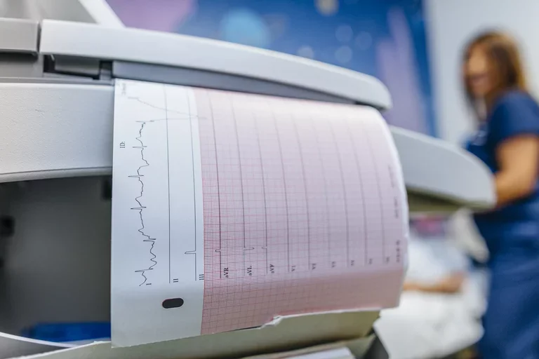 What Is a Cardiologist? Heart rhythm chart 