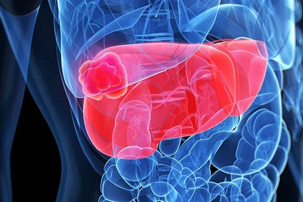 1984-ronald-busuttil-M.D.-Ph.D.-at-the-medical-school-opens-the-first-liver-transplant-program-on-west-coast