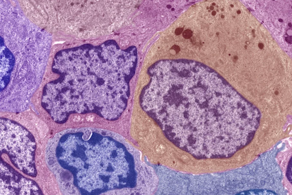 Cancer-Metabolism-Lethal-Stress